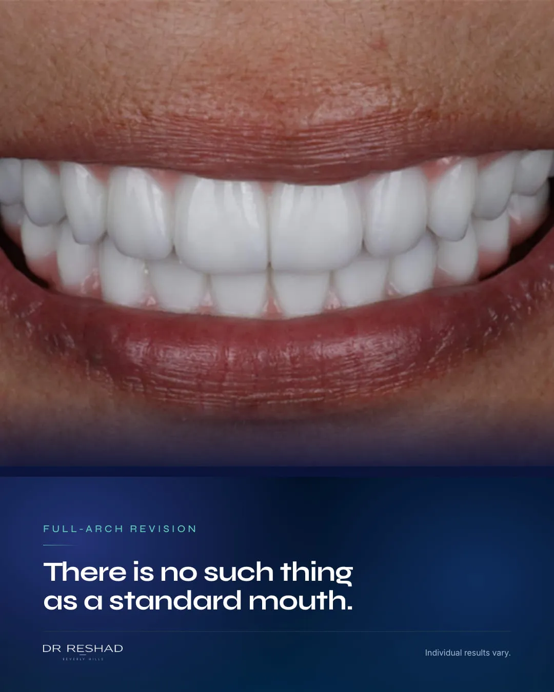 An Instagram case post: There is no such thing as a standard mouth.